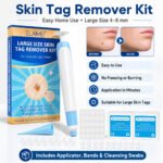 Natural Painless Skin Tag Removal Kit Micro Bands Remover Device