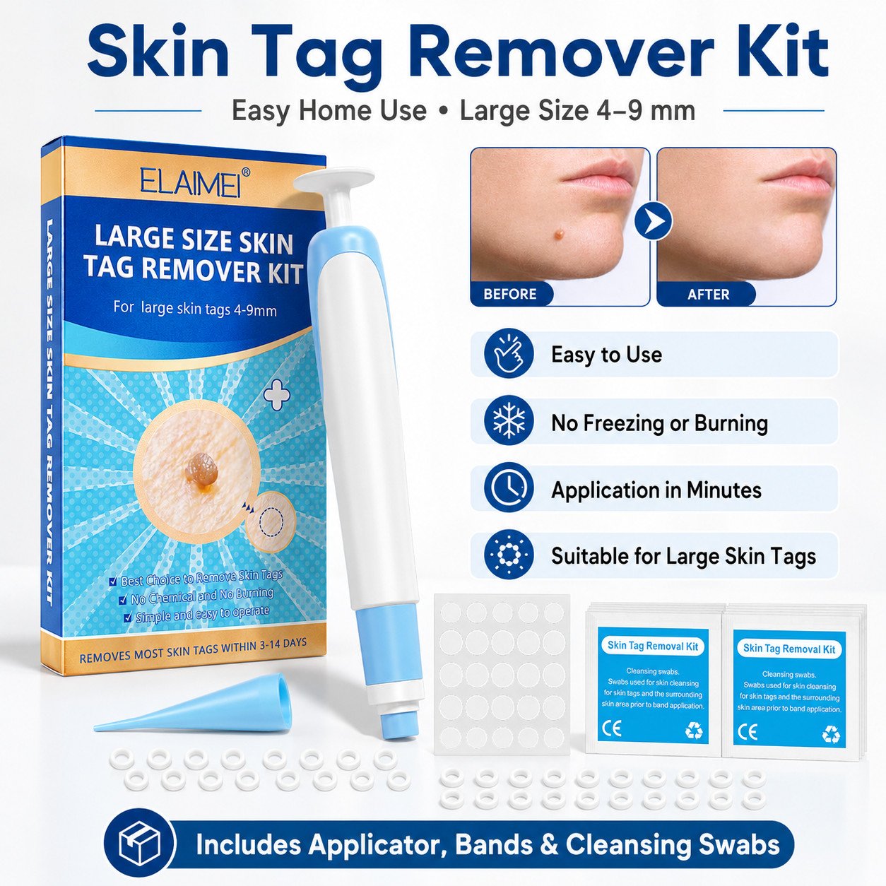 Natural Painless Skin Tag Removal Kit Micro Bands Remover Device Natural Painless Skin Tag Removal Kit Micro Bands Remover Device